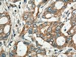 BEGAIN Antibody in Immunohistochemistry (Paraffin) (IHC (P))