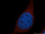 RPS15 Antibody in Immunocytochemistry (ICC/IF)