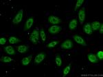 RBM8A/Y14 Antibody in Immunocytochemistry (ICC/IF)