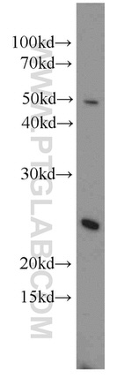 RBM8A/Y14 Antibody in Western Blot (WB)