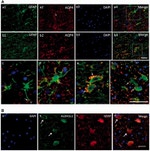 ALDH1L1 Antibody in Immunohistochemistry (IHC)