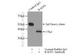 RAD51 Antibody in Immunoprecipitation (IP)