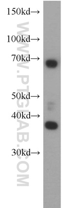 RAD51 Antibody in Western Blot (WB)