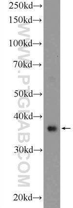 RAD51 Antibody in Western Blot (WB)