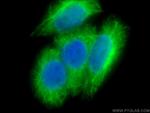 Cytokeratin 19 Antibody in Immunocytochemistry (ICC/IF)