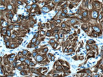 Cytokeratin 19 Antibody in Immunohistochemistry (Paraffin) (IHC (P))