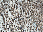 Cytokeratin 19 Antibody in Immunohistochemistry (Paraffin) (IHC (P))