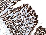 Cytokeratin 19 Antibody in Immunohistochemistry (Paraffin) (IHC (P))