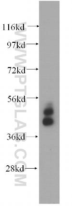 Cytokeratin 19 Antibody in Western Blot (WB)