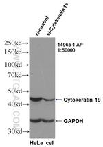 Cytokeratin 19 Antibody in Western Blot (WB)