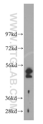 Cytokeratin 19 Antibody in Western Blot (WB)