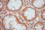 DDAH2 Antibody in Immunohistochemistry (Paraffin) (IHC (P))