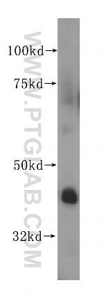 DDAH2 Antibody in Western Blot (WB)
