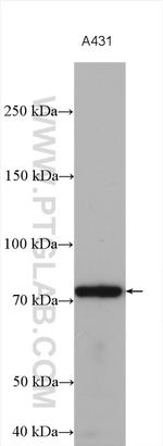 KATNB1 Antibody in Western Blot (WB)