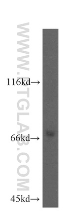 KATNB1 Antibody in Western Blot (WB)