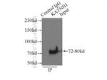 KATNB1 Antibody in Immunoprecipitation (IP)