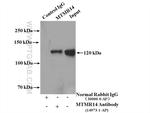 MTMR14 Antibody in Immunoprecipitation (IP)