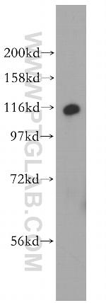 MTMR14 Antibody in Western Blot (WB)