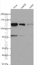 MTMR14 Antibody in Western Blot (WB)