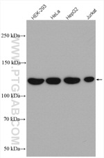 MTMR14 Antibody in Western Blot (WB)