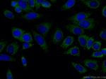 UQCRQ Antibody in Immunocytochemistry (ICC/IF)