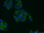 UQCRQ Antibody in Immunocytochemistry (ICC/IF)