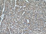 UQCRQ Antibody in Immunohistochemistry (Paraffin) (IHC (P))