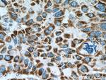 UQCRQ Antibody in Immunohistochemistry (Paraffin) (IHC (P))