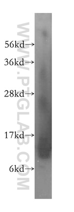 UQCRQ Antibody in Western Blot (WB)