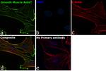 Alpha-Smooth Muscle Actin Antibody in Immunocytochemistry (ICC/IF)