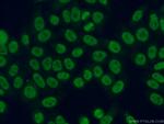 SNRPF Antibody in Immunocytochemistry (ICC/IF)