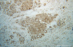 SNRPF Antibody in Immunohistochemistry (Paraffin) (IHC (P))