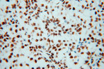 SNRPF Antibody in Immunohistochemistry (Paraffin) (IHC (P))