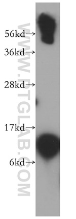 SNRPF Antibody in Western Blot (WB)