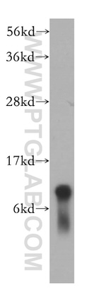SNRPF Antibody in Western Blot (WB)