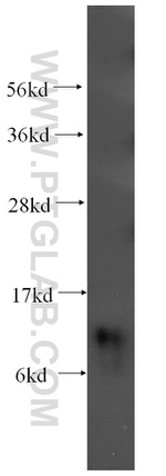 SNRPF Antibody in Western Blot (WB)