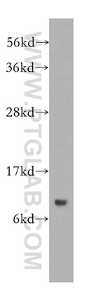 SNRPF Antibody in Western Blot (WB)