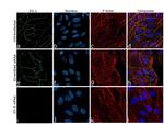 ZO-1 Antibody in Immunocytochemistry (ICC/IF)