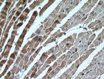 AK1 Antibody in Immunohistochemistry (Paraffin) (IHC (P))