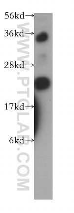 AK1 Antibody in Western Blot (WB)