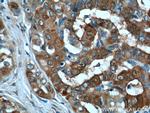 Galectin-3 Antibody in Immunohistochemistry (Paraffin) (IHC (P))