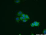 Galectin-3 Antibody in Immunocytochemistry (ICC/IF)