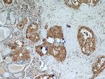 Galectin-3 Antibody in Immunohistochemistry (Paraffin) (IHC (P))