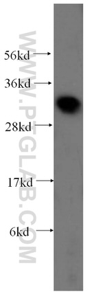 Galectin-3 Antibody in Western Blot (WB)