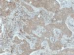 PPA1 Antibody in Immunohistochemistry (Paraffin) (IHC (P))