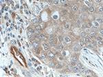 PPA1 Antibody in Immunohistochemistry (Paraffin) (IHC (P))