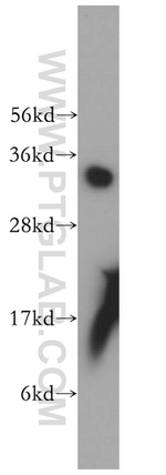 PPA1 Antibody in Western Blot (WB)