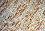 S100A13 Antibody in Immunohistochemistry (Paraffin) (IHC (P))