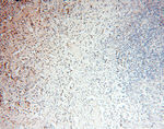 S100A13 Antibody in Immunohistochemistry (Paraffin) (IHC (P))