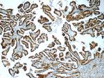 S100A13 Antibody in Immunohistochemistry (Paraffin) (IHC (P))